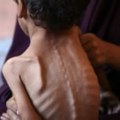 U Gazi još devet osoba umrlo od neuhranjenosti zbog izraelske blokade humanitarne pomoći