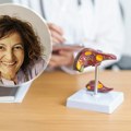 Kako se leči hepatitis A? Infektolog objašnjavaju zašto su odmor i ishrana najvažniji