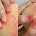 K-beauty trend pod lupom: Fruit peel nokti osvajaju kraj letnje sezone! Egzotičan ukus nove Eva riblje salate: Eva losos…
