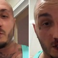 Srpski reper usred noći objavio jeziv snimak! Krv mu se sliva niz lice, spomenuo batine