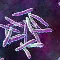 Bolest prošlosti hara u Engleskoj: Stručnjaci upozoravaju da je cela Evropa u riziku od epidemije tuberkuloze, kakva je…