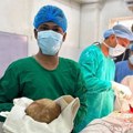 Lekari uklonili kamen težak 3,1 kilogram iz bešike pacijenta