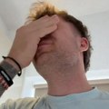 "Kad sam ovo video znao sam da je rak" Muškarac (31) ignorisao važan simptom opake bolesti koja je sve češća kod mladih