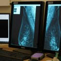 Mobilni mamograf u Vrnjačkoj Banji i Užicu: Ovo su telefoni putem kojih možete zakazati pregled