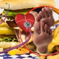 „Tihi ubica“ obično ne daje simptome: Tri promene na stopalima ukazuju na povišen holesterol