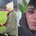 Pretučen sudija koji je zaprosio partnera na utakmici Kelna