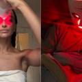 Šta je red light terapija? Popularnost je i više nego opravdana!
