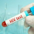 U Srbiji za 11 meseci ove godine 109 osoba dobilo dijagnozu HIV-a, umrlo pet