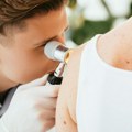 Proverite svoje mladeže pre odlaska na more! Leto je pravo vreme za to: 10% popusta na dermatološki pregled do 15. jula u…