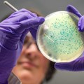 Veštačka inteligencija pronašla antibiotike za gonoreju i MRSA superbakterije