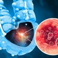 Crne prognoze: Broj novoobolelih od raka porašće za 77 odsto