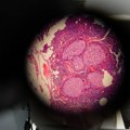 Od laboratorije do biološkog oružja: Zašto je sve teže razlikovati naučna istraživanja od opasne zloupotrebe