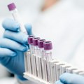 CAR T-Cell terapija: Najnaprednija ćelijska imunoterapija u lečenju tumora