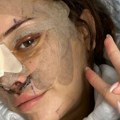 Zatezanje lica u 28. godini: Mladi se okreću plastičnoj hirurgiji