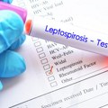 Epidemija se širi Sarajevom, potvrđena i u Crnoj Gori! Ako ovo činite, dovešćete se u opasnost - evo kada se očekuje da…