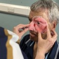 Povređeni biciklista dobija novo 3D lice