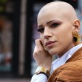 Zdravlje: „Mnogo više dobijete nego što izgubite", priče ljudi koji žive sa alopecijom