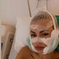 Ermina Pašović pukla mnogo hiljada evra kako bi postala lepotica! Najviše para joj trebalo da sredi oči, tu su i veće…