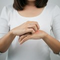 Dermatolog navodi nekoliko navika koje mogu da pogoršaju ekcem