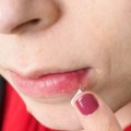 Herpes i Alchajmerova bolest: Dokazana je nova veza, da li treba da brinemo