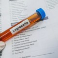 Simptomi koji ukazuju na zarazu legionelom - lečenje može duže da traje
