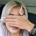 Spustila je ruku i šokirala milione: Ovako nešto se retko viđa, svi se pitaju da li su prave