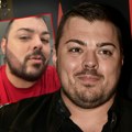 Sloba Vasić presadio bradu u Turskoj: Pevač otkrio odakle su mu prvo skinuli dlake - crvenilo se vidi i posle 20 dana (video)