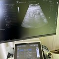 Preventivni pregledi u zc Vranje: 45 uz dojki i 178 prostate