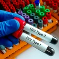 Od pojave HIV-a u Srbiji više od 4.700 inficiranih