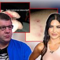 "Ovako izgleda kada Jelena bije" Ivan Marinković objavio uznemirujuće fotografije, tvrdi da mu je rane nanela bivša žena