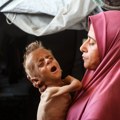 (Foto) glad, strah i smrt: Najpotresnije slike iz Gaze, ovako izgledaju deca! Čim prohodaju ostaju bez nogu, a o hrani…