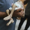 Trinaestoro dece iz Gaze lečiće se u Španiji: "Situacija u Gazi je apsolutno užasna"