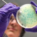 Veštačka inteligencija pronašla antibiotike za gonoreju i MRSA superbakterije