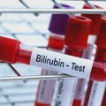 Kako smanjiti bilirubin u krvi ishranom?