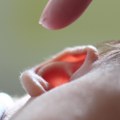 Nova studija: Genska terapija pomaže kod urođenih problema sa sluhom