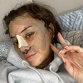 Zatezanje lica u 28. godini: Mladi se okreću plastičnoj hirurgiji