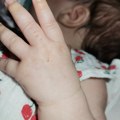 U Jablaničkom okrugu 13 obolelih od velikog kašlja, među njima i sedmomesečna beba