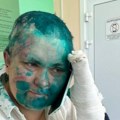 Obrijali joj glavu, zalili je farbom! Čečeni uhvatili prozapadnu novinarku, slike zapalile mreže! (foto)
