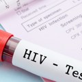 Za godinu dana u Srbiji registrovano 109 novih slučajeva HIV-a Batut objavio istraživanje povodom Svetskog dana borbe protiv…