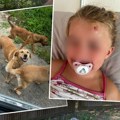 Komšinica u dvorištu drži 40 pasa: Mesec dana od napada na trogodišnju devojčicu u Ćupriji još uvek nema rešenja (foto)