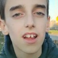 Mihajlo (17) govori svega nekoliko reči i ne može mnogo toga sam: Porodici potreban novac za brojne tretmane