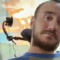 Ne može da pomera glavu, ali sada "gleda" gde želi: Maskov čip u mozgu mu dao drugi par očiju