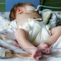 Oglasilo se Ministarstvo zdravlja: Evo koliko ima zaraženih velikim kašljom i kad su tačno bebe umrle! Nema dugotrajnog…