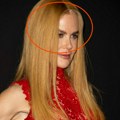 Nikol Kidman progovorila nakon velikog gafa sa perikom: Glumica priznala šta se dogodilo "Svi me pitaju isto"