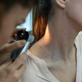 Studija: u porastu broj slučajeva obolelih od melanoma u Britaniji