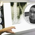 Neverovatna priča o dr Aleksandru Babiću kojem je srce kucalo s desne strane: Bio je medicinski fenomen, a lečeći…