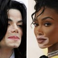 Svetski dan vitiliga: Sve o stanju zbog kojeg je Majkl Džekson promenio boju kože, a Vini Harlou stekla slavu