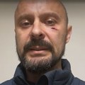 Pretučeni odbornik Kreni-promeni: Osobe iz Ćacilenda napale i mog kolegu dok smo bili sa policajcima, oni samo spustili glave…