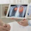 Pet manje poznatih simptoma raka pluća