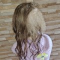 Devojčici iz Leskovca jedna od 100 na svetu: Sofiji rastu tri vrste kose na glavi - lekari zbunjeni (video)